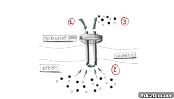 IMcoMET's innovative microneedle device for interstitial fluid extraction.