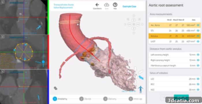 Detailed view of FEops AI simulation process for cardiac interventions