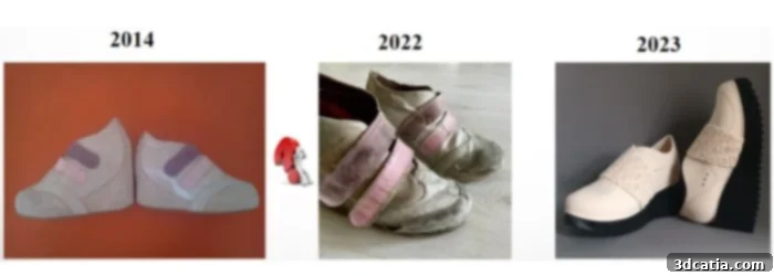 The journey from traditional orthopedic footwear to modern 3D printed solutions