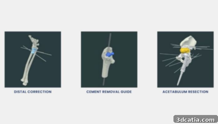 Additional examples of customized 3D printed surgical guides, highlighting their intricate designs and specific anatomical fit.