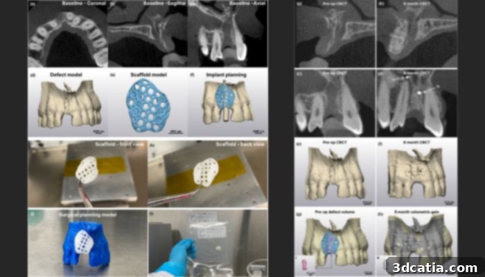 Results showing the jawbone as well as the lattice and the final results of 3D printed bone scaffolds in jaw reconstruction.