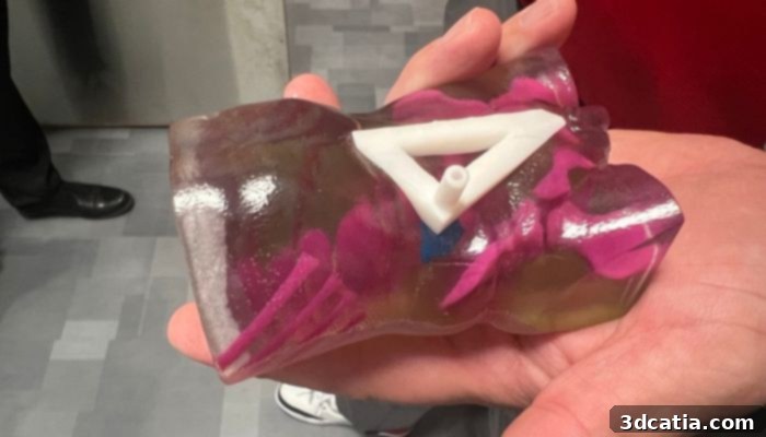 3D printed anatomical model used for surgical planning