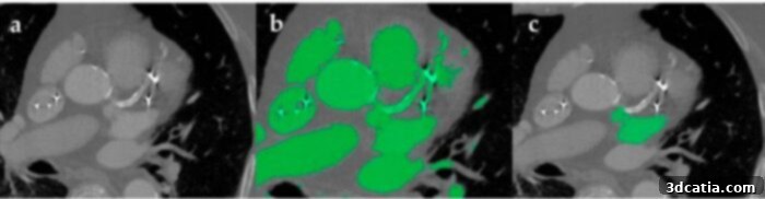 Image segmentation process demonstrating manual vs automatic segmentation in medical imaging.