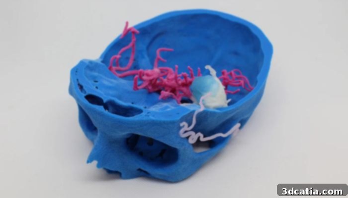 3D printed surgical model of a cerebral artery aneurysm.
