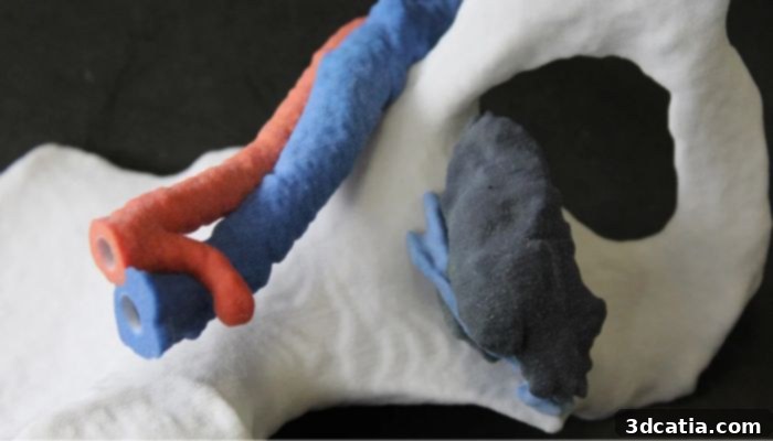 Surgical model of a pelvic tumor with surrounding vessels.