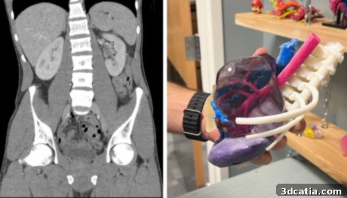 Comparison of a CT scan with a 3D printed anatomical model of an abdominal tumor.