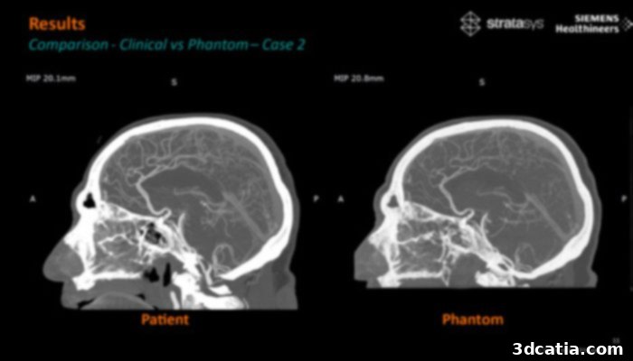 Stratasys and Siemens Healthineers 3D printed medical imaging phantoms