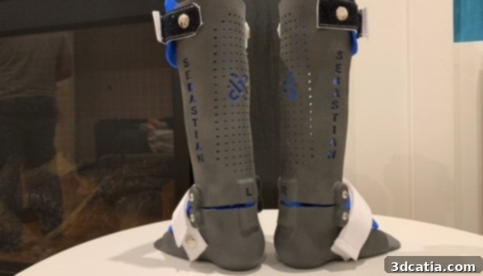 3D printed orthosis in a medical setting
