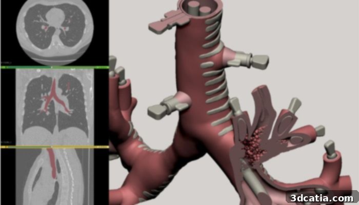 Simpath’s 3D airway model.