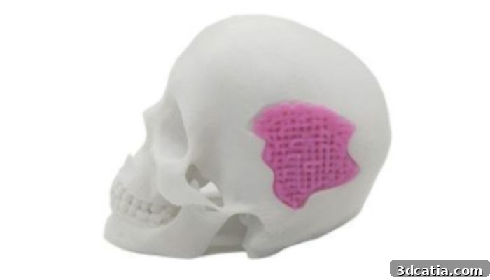 3D printed implant made from bioactive glass.