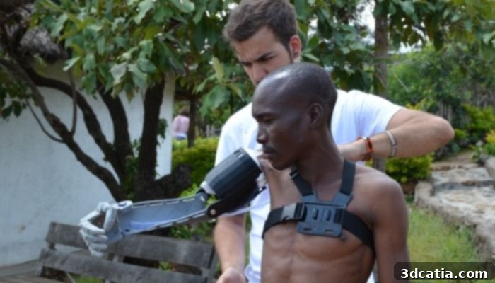 Leading Innovations in 3D Printed Prostheses 11 3D printed prostheses for humanitarian aid