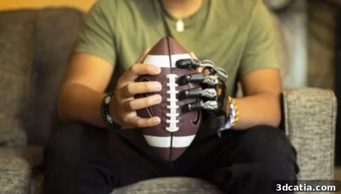 Naked Prosthetics Resin 3D Printed Finger Prosthesis