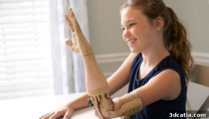 3D Printed Prostheses by Unlimited Tomorrow