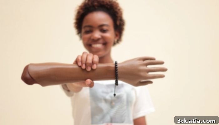 LimbForge 3D Printed Prosthetic