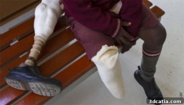 3D printed prosthetics