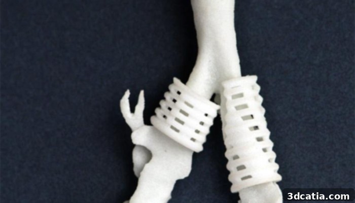 3D printed Tracheal Splint