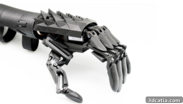 Detailed view of the Youbionics bionic hand within the arm