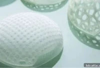 LATTICE MEDICAL Secures Record €43 Million to Revolutionize Breast Reconstruction