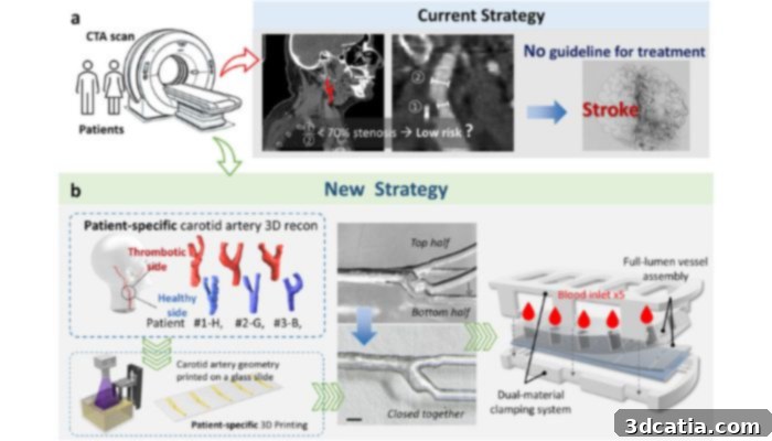 Visualization of stroke risk assessment strategies