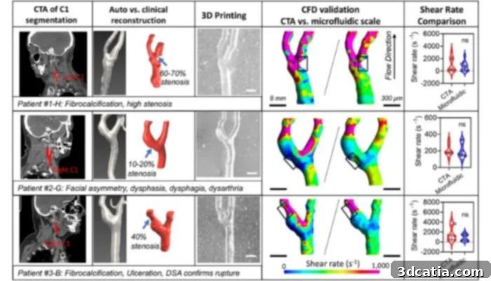 3D reconstruction of patient-specific carotid artery