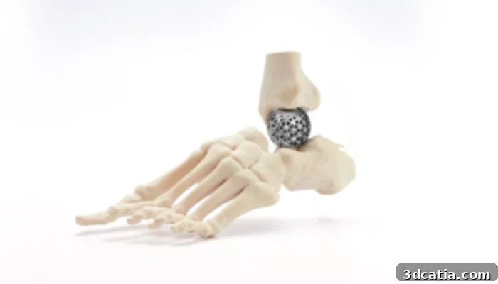 Talus Reconstruction