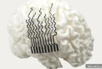 3D-Printed Electrodes Custom-Fitted to Individual Brains for Better Neural Implants