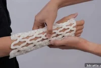 4D Printing Replaces Casts: The Future of Orthopedic Care